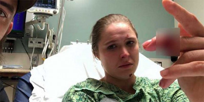 Ngeri, Jari Ronda Rousey Hampir Putus Saat Syuting! thumbnail